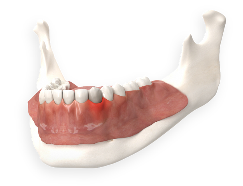 Ihr Zahnarzt in Bergheim: Zahnerhalt, Zahnersatz & Implantate